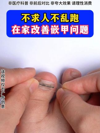 不求人不用跑,嵌甲问题就该用它改善 zrl#甲沟炎#嵌甲#脚趾甲往肉里长怎么办#实用小技巧 #好物推荐🔥