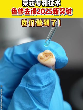 牙齿黄黄的真的很减分,你就给它七天时间,真的不会让你失望!#清新口气 #牙黄咋办