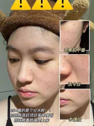 35岁天天熬夜带娃,还能有这种皮肤状态? #抗皱紧致提升 #荟妍朵 #双层精华油 #水油同补