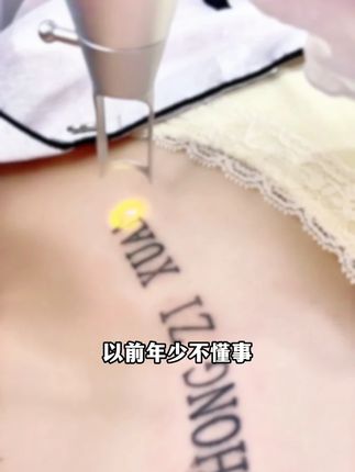 家用激光皮秒笔,精准高效安全,轻松解决问题