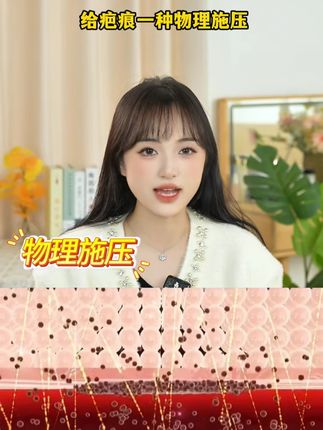 究竟是谁把疤痕贴炒成奢侈品的? 想要平价又好用的疤痕贴 选择【修正医用疤痕贴】准没错 📦一盒三贴,采用独立密封包装,贴近肤色,贴在腹部几乎隐形;大贴片设计,包裹性强,可以根据疤痕大小随意裁剪,日常活动也不会卷边移位;脏了水洗还能反复使用,粘性依旧给力! 🔮核心成分是进口硅凝胶,背靠大厂,哺乳期宝妈、敏皮姐妹、儿童都可以用,能够深入皮肤底层,通过物理施压预防和抚平增生,从而来淡化疤痕 #无限回购的宝藏单品 #疤痕 #剖腹产 #疤痕增生 #疤痕体质
