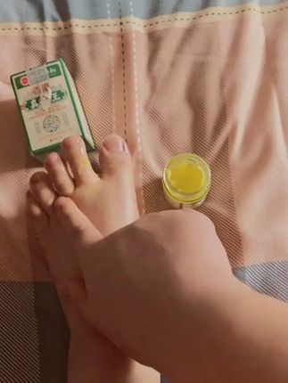 这个香港的老牌子真的很好用!#真菌王