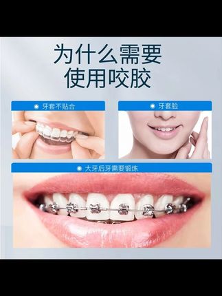 戴牙套后试了好多咬胶,发现还是这个扁扁的兔子咬胶不打滑又耐咬#时代天使 #牙套脸 #隐形牙套 #爱牙护牙