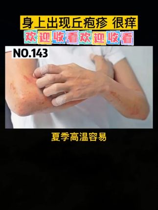 #夏日皮肤急救  #降温舒缓  #户外护肤  #成分实验室  #敏感肌宝藏