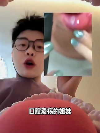 口腔溃疡反反复复的朋友就用它#口腔溃疡 #口腔溃疡怎么办 #口腔溃疡小妙招 #口腔溃疡的痛谁懂 #嘴巴长泡 #20-A