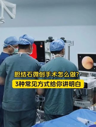 胆结石微创手术怎么做?3种常见方式给你讲明白 #抖出健康知识宝藏 #健康科普不基础 #胆结石