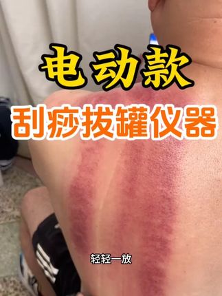 #按摩仪 可拔罐 可刮痧可热敷,自己用送长辈都合适 5