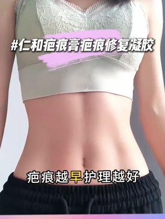 对付疤痕,80%的人都做错了#疤痕 #去疤 #关爱女性健康 #硬核健康科普行动 #疤痕凝胶