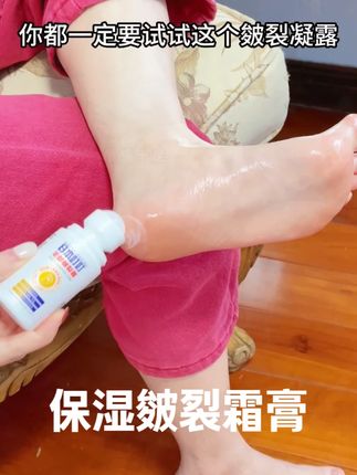 日本叮叮足部皴裂凝露脚后跟干裂起皮干燥保湿皴裂霜膏手脚皲龟裂