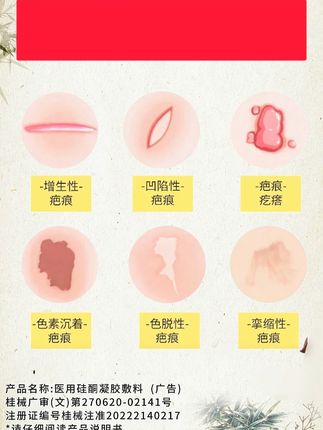重视疤痕护理 不要等疤痕增生定型了才后悔 #疤痕 #疤痕增生 #祛疤膏