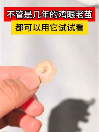 有鸡眼问题的不要错过,一招在家就能改善鸡眼 #鸡眼去除小妙招 #手足护理 #老茧 zrl