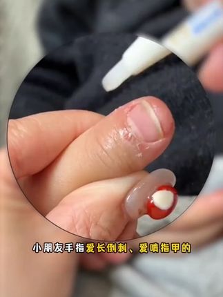 润本指缘精华乳指缘油儿童宝宝改善倒刺指甲边缘营养油非苦甲水#儿童指缘油 #润本好物 #宝宝倒刺护理 #指缘精华乳 #指甲营养油