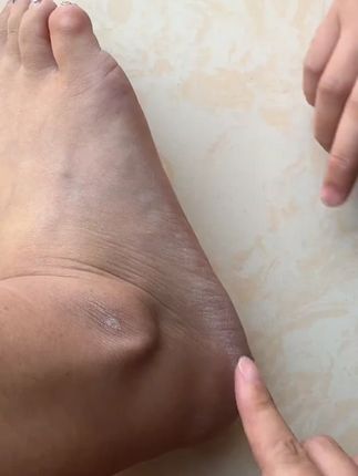 磨脚神器去死皮脚磨脚石修脚刀搓脚神器去死皮脚后跟老茧工具#磨脚神器 #去死皮工具 #修脚刀 #脚后跟老茧 #足部护理