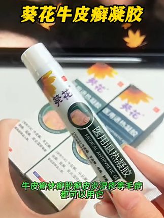 有牛皮癣,足癣,体癣的朋友快试试葵花牛皮癣退热凝胶 #牛皮癣 #牛皮癣患者 #手足癣 #葵花 #皮癣