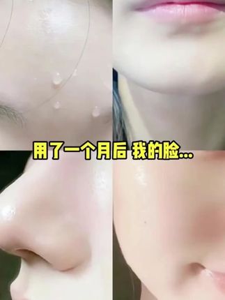 换季不保养!皮肤干燥又粗糙!显得老! 那就试试#星空里 #马来西亚甘油 !早晚涂一涂,以油养肤!改善皮肤问题!#维e护肤甘油 #亲测分享 #好皮肤养出来 w