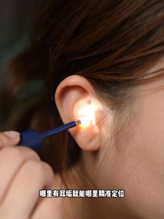 可视化的耳朵护理仪,不管是给孩子还是给自己掏耳朵,那是真香啊 #掏耳朵 #家用可视掏耳勺 #bebird