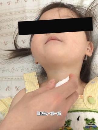 宝宝金水草本原液婴幼儿童防痱清凉止痒泡洗澡花露水痱子水喷雾 尿不湿伴侣,宝宝就脖子淹红,赶紧入宝宝金水#爽身 #精致妈妈 宝宝用太合适了 #母婴好物 #亲子