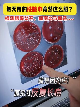洗脸巾别再用错了,真的会烂脸!野时明确标注100%纯棉洗脸巾,采用优质新疆棉,用得才放心!#棉花做的洗脸巾才叫棉柔巾 #洗脸巾 #超便宜超划算 #生活小常识 #洗脸巾推荐