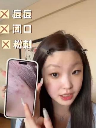 惠敏一直在用的美白修护精华~趁生日的优惠赶紧薅!#美白 #修护 #精华 #美迪惠尔 #金惠敏