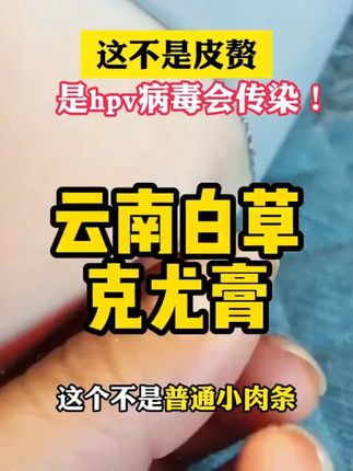 坚持涂它几天,看看你的有什么变化!其实改善很简单#脖子上的小肉粒 #怎么袪除疣 #扁平疣 #肉刺瘊子肉粒怎么袪除 #趾疣