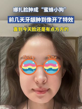 娜扎肿成了“蜜蜂小狗”