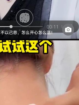 改善腋下、膝盖、脖子皮肤暗沉用 #维a酸乳膏 + #尿素维e乳液 一白遮百丑, #精致女人必备# 女性保养 #变美攻略