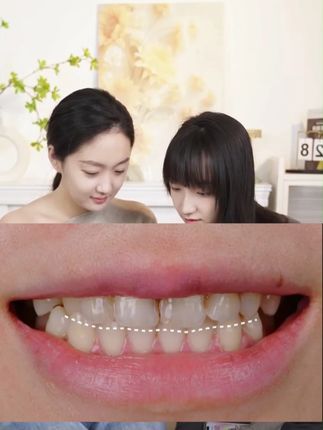 栀子白茶牙膏也来活动了 #好物推荐 #牙膏 #牙膏推荐 #栀子 #白茶