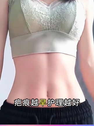 对付疤痕,80%的人都做错了#疤痕 #去疤 #关爱女性健康 #硬核健康科普行动 #疤痕凝胶