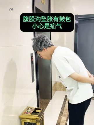 腹股沟坠胀有鼓包,小心是疝气! #腹股沟疝 #疝气 #疝气带