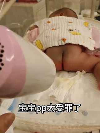 澳兰黛蛋黄油护臀膏新生儿红屁屁专用宝宝滋润屁屁霜婴儿婴儿用品#澳兰黛护臀膏 #蛋黄油护臀膏 #宝宝红屁屁 #婴儿用品 #屁屁霜