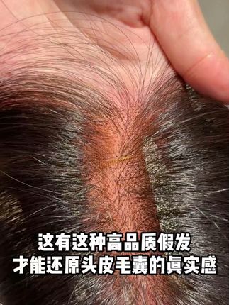 只有这种高品质假发才能还原头皮毛囊的真实感#自然假发推荐 #佳丽仟丝假发 #洋气减龄 #头发蓬松显脸小