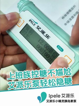 上班族控糖不尴尬,艾派乐泵精细输注,不用频繁扎针#糖尿病 #血糖 #艾派乐胰岛素泵 #一型糖 #二型糖