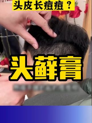 头皮痒,还有一层厚厚的结痂,不要用手抠掉,可以试试这样处理#头癣 #健康科普