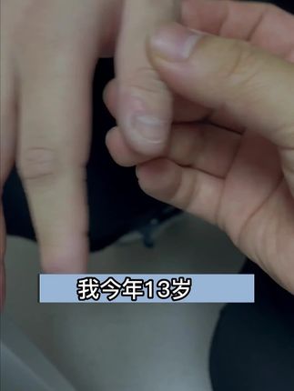 fairycare苦瓜膏,帮大童戒掉咬甲咬唇坏习惯! #大童咬甲克星 #防咬唇产品 #苦甲水推荐 #fairycare苦瓜膏 #戒吃手好物