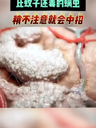 洗衣机槽里面有小菌菌,快用这款洗衣机清洁剂,深度清洁