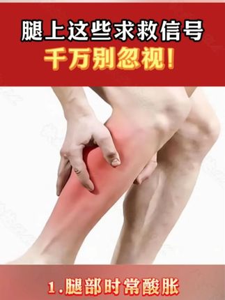 腿上这些信号,千万别忽视 #静脉曲张#静脉曲张怎么办#静脉曲张老烂腿#腿部护理#好物推荐🔥
