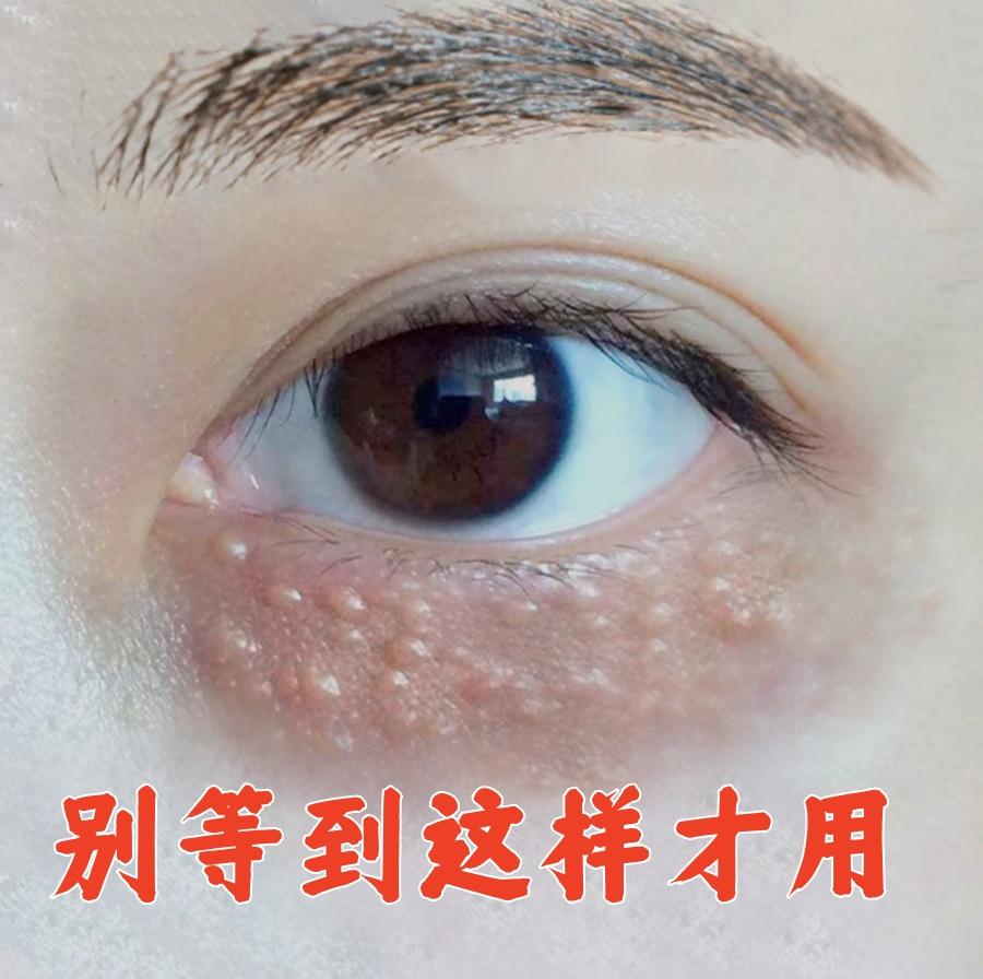 【香港研发】眼部眼霜 眼部小粒粒 颗粒