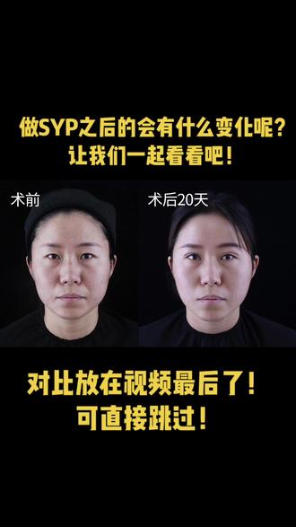 做了SYP只会会有什么变化呢?让我们一起来看看吧!
南京韩辰|南京韩辰整容|韩辰整形|吸脂|双眼皮 |南京韩辰整形医院|医疗美容
#南京韩辰#南京韩辰医疗美容#双眼皮 #专业的事交给专业的人
