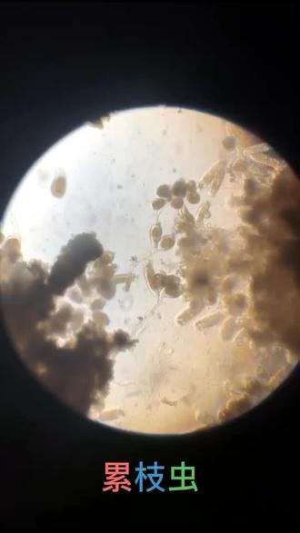 斑点叉尾鮰口腔溃烂处寄生累枝虫。