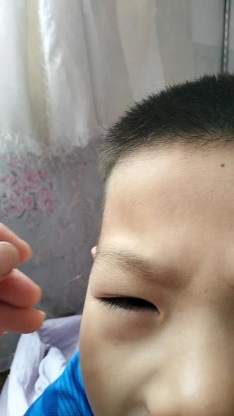儿子眉毛上长了一根白发是怎么回事啊
