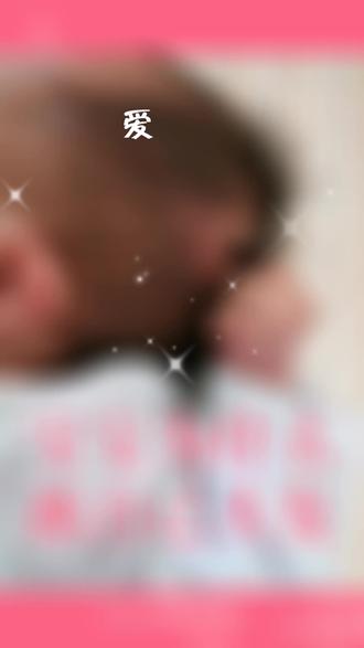 我狠起来连自己头发都抓
导致宝宝爱抓自己头发的原因如下:
自然现象,宝宝出生时手攥着, 西,是无意识,所以会出现抓自己头发,即使抓疼了也不撒手的现象。
随着宝宝的发育,这种现象会慢慢消失,家长不用过度担心。
背2、由家长害怕碰出囟门处,所以不敢洗头发,导致头部的汗液和脱落的头皮细胞,还有灰尘黏在一起,刺激头皮,产生痒的感觉,导致宝宝出现抓自己头发的现象。
过敏体质的宝宝如果头部患有湿疹
宝宝喜欢抓头发,渐渐地应该会改掉的,如果不放心的话,可以让宝宝带上小手套,以免宝宝会伤害到自己。不过如果有人照看在旁的话 最好还是不要让宝宝戴手套哦!#新生儿护理 #母婴护理#徐姐分享💕💕💕