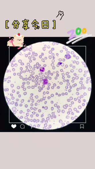 淋巴细胞最漂亮百变小魔女