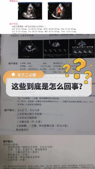 施耐庵的真名叫什么 63a06523f7794b37bf4013efd3930eac_1680660089~tplv-dy-resize-origshort-autoq-75:330.jpeg?x-expires=2015848800&x-signature=BatAVyLSwIXdZNN%2Bx4OtZ4yGN3g%3D&from=3213915784&s=PackSourceEnum_AWEME_DETAIL&se=false&sc=cover&biz_tag=pcweb_cover&l=202311202257569A65E52D0064F0430061