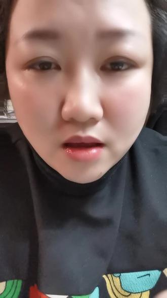 关于化疗,如果接不上,大家翻前翻