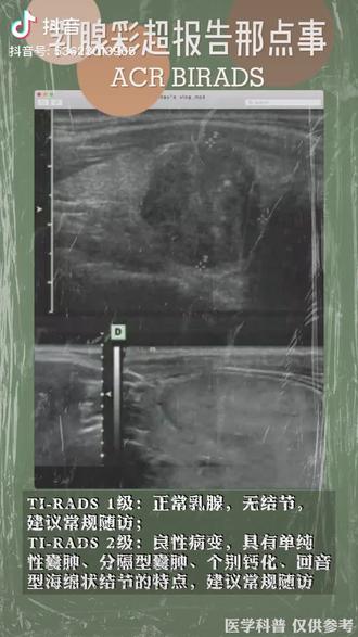 之前一个乳腺b超的医生说:我们一般不写级别,怕不准!保养先做好,不要等医院出指标!