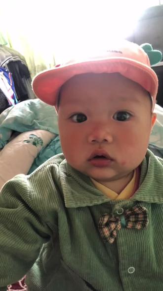 本来两个大眼睛的肿了下次就变成一大一小了想问问还能恢复吗