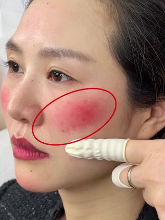 #精华油 🍀角鲨烷屏障呵护油🍀 为什么要以油养肤? 因为油能锁住皮肤的水份 油包裹住了水份 保护脸上的细胞当肌肤屏障受损时 以油养肤相当于重建皮脂膜 从而保护肌肤免受外界刺激 也能预防肌肤水分流失。