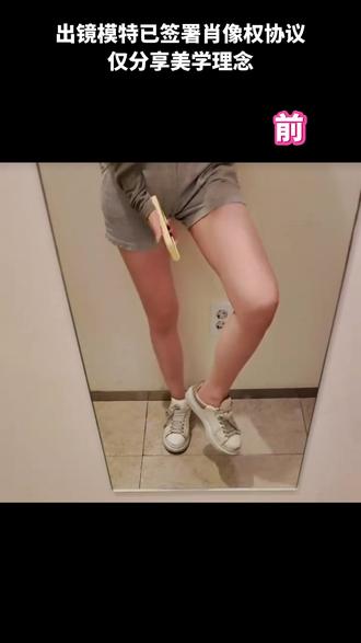 大腿顽固脂肪怎么都瘦不掉?Onda如何呢🔥 很多宝宝到了夏天想穿小裙子
但是会发现自己明明不是很胖
但大腿内侧、外侧的肉就是特别难减🥲
裤子卡腿、腿型不直、拍照显壮……
那你一定要知道Onda微波溶脂!!!!!
针对大腿顽固脂肪和橘皮感真的很友好✨
#首尔病 #韩国变美 #Onda #大腿粗 #变瘦变美变漂亮