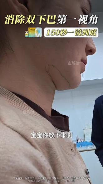 沉浸式消除双下巴 #医疗健康创作训练营#金璐怡#思路#蓉芷#双下巴
