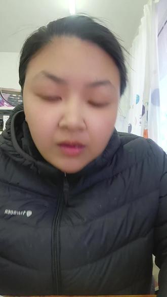 喝酒的危害。 一酒精套肝脏分解,长期喝,一步步会变成酒精肝,脂肪肝,肝硬化,甚至说是肝癌。
二喝酒直接腐蚀胃粘膜,容易胃痛,胃炎,胃溃疡,胃出血。
三,反应慢,记忆力下降,手抖,失眠,情绪暴躁。
四,高血压,心脏病,中风的风险非常的高。
五,胰腺急性胰腺炎,疼到要命,有可能致命。
六,致癌,伤害免疫力,影响情绪,影响外貌。
七,容易冲动吵架出事。
八,酒驾,醉驾一次能毁一生。
九,花钱多,伤身体又伤财。#酒驾#醉驾#肝硬化#胃溃疡#爱你的人 #高血压